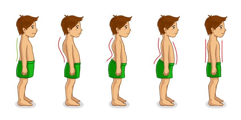 Badania postawy u dzieci.